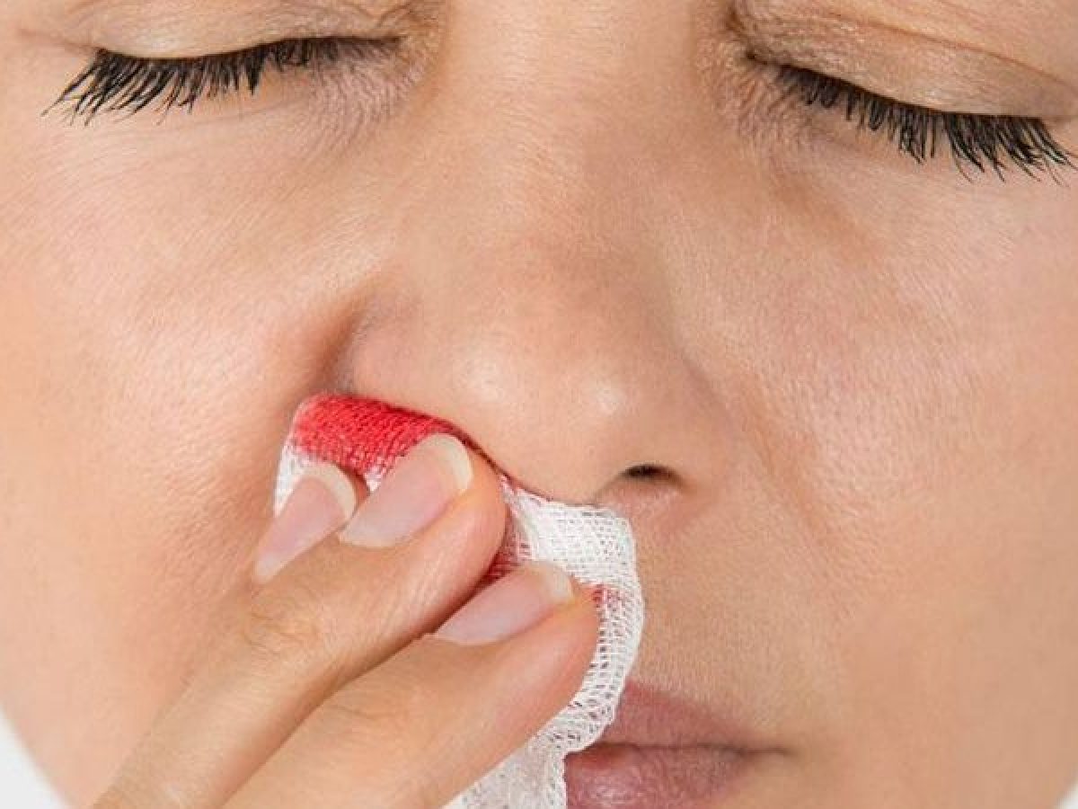 Nose Bleed in Children: Causes, Prevention and Treatment