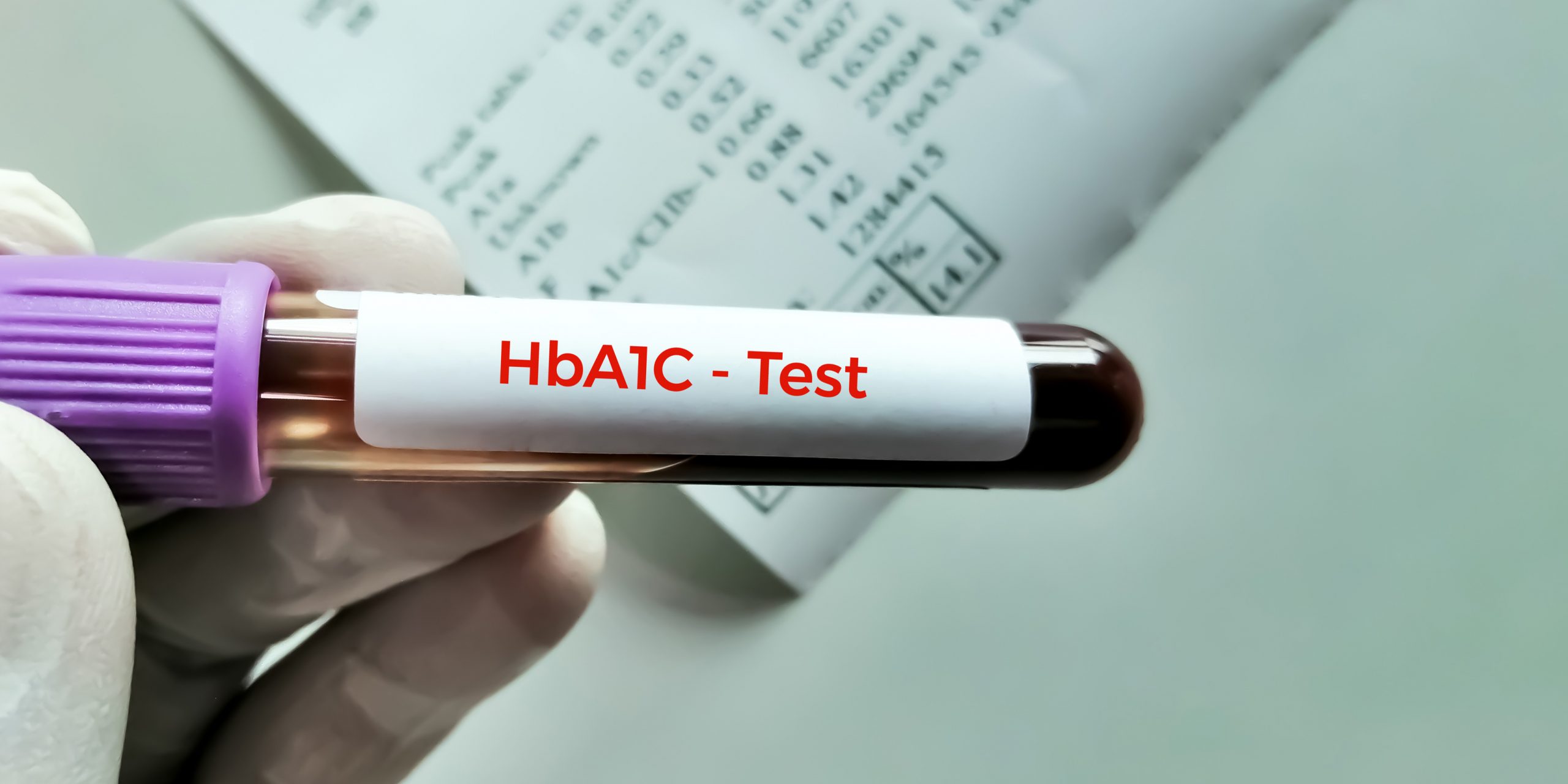 What a 1% in HbA1c can mean for you What a 1% in HbA1c can mean for you