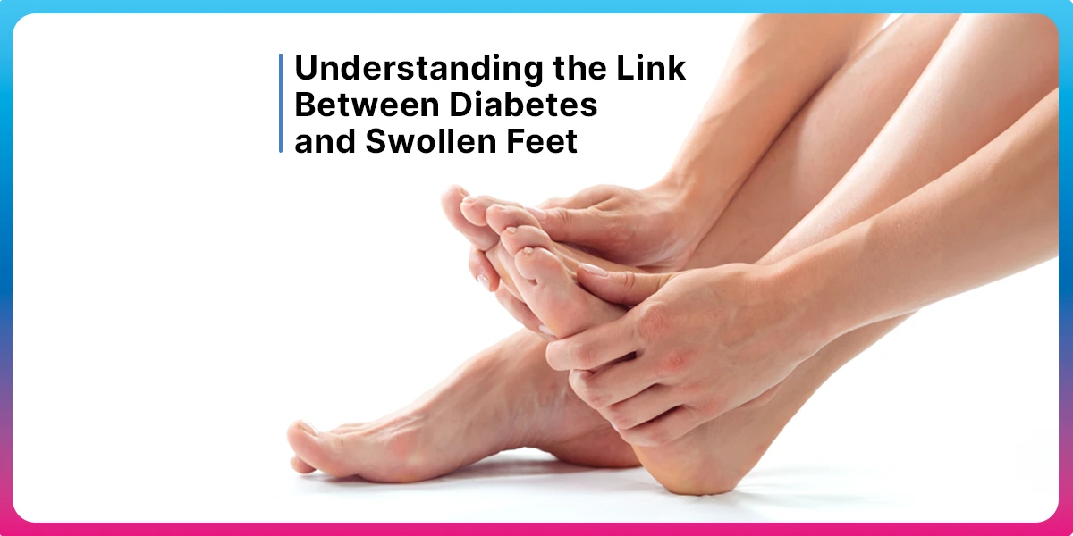 Understanding the Link Between Diabetes and Swollen Feet - Fitterfly