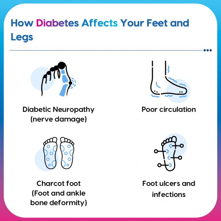 Footcare Tips For People with Diabetes During Monsoons Fitterfly