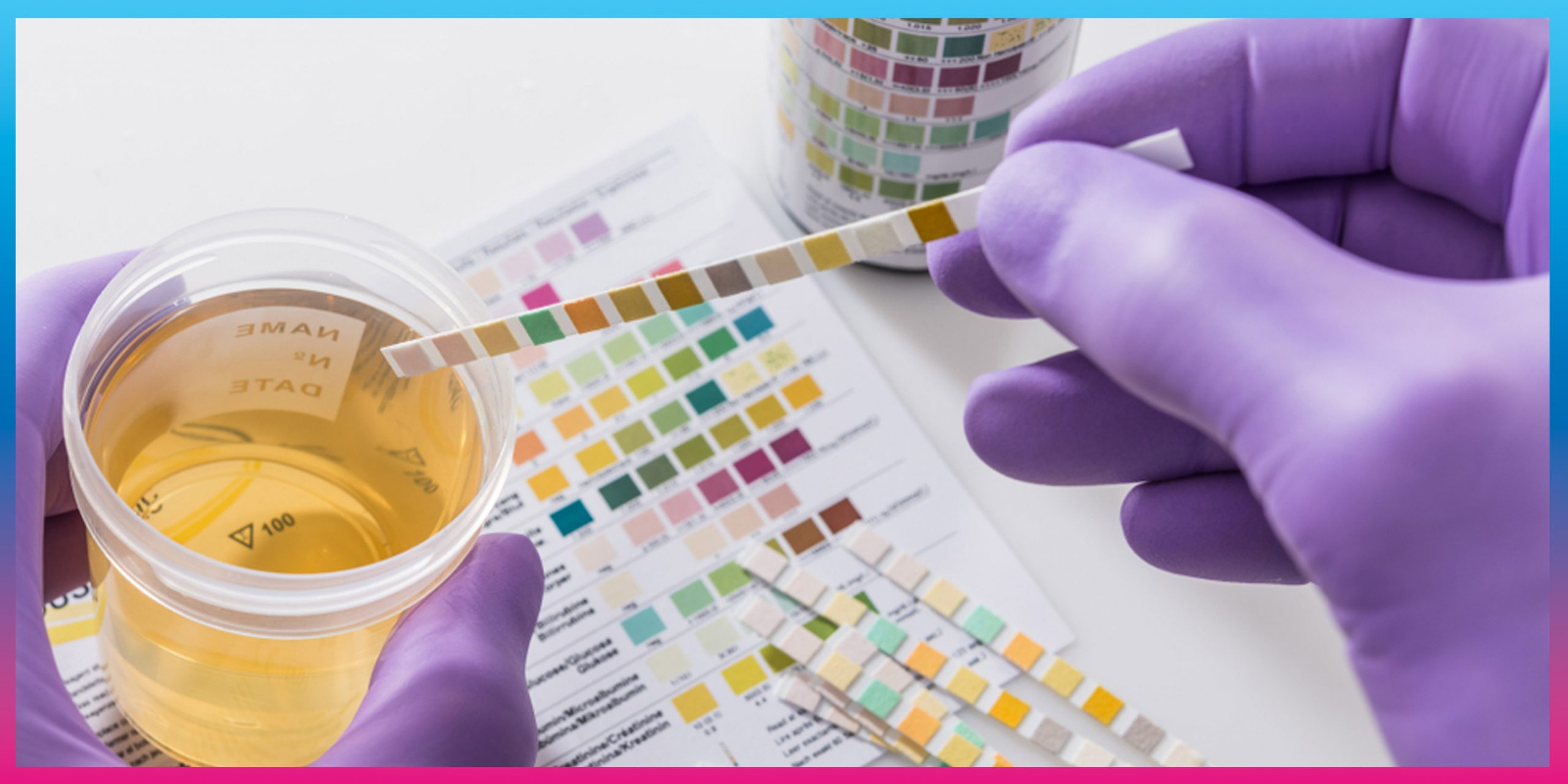 Urine Glucose Test